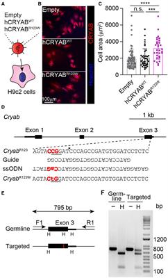 A novel αB-crystallin R123W variant drives hypertrophic cardiomyopathy by promoting maladaptive calcium-dependent signal transduction